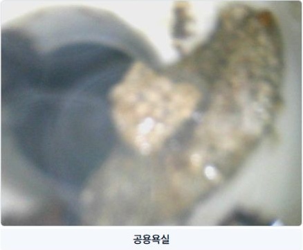 실제 완료 보고서의 공용욕실 사진과 위치 표기 발췌입니다. 원본 내시경 영상의 색과 관찰 내용을 유지했습니다.